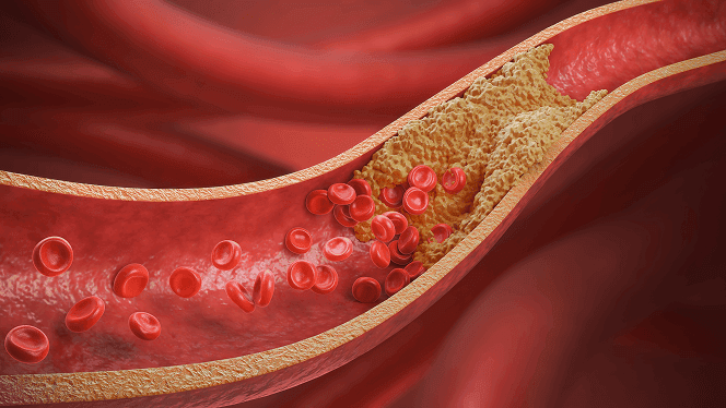 Blood Flow Slows Down