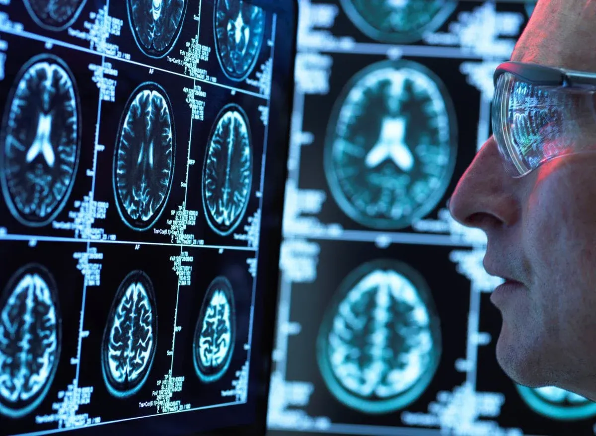 Brain Function