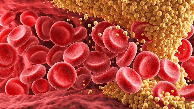Fibrin & Plaque Formation