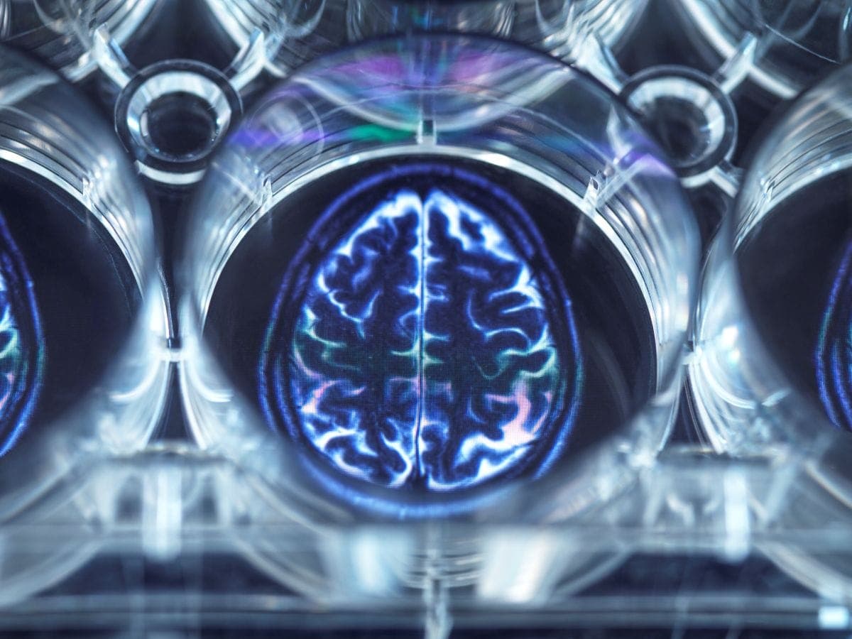 Brain