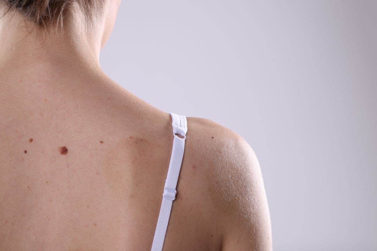 Tissue Repair