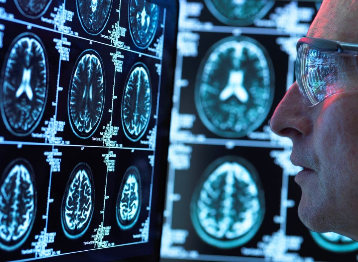 Brain Function