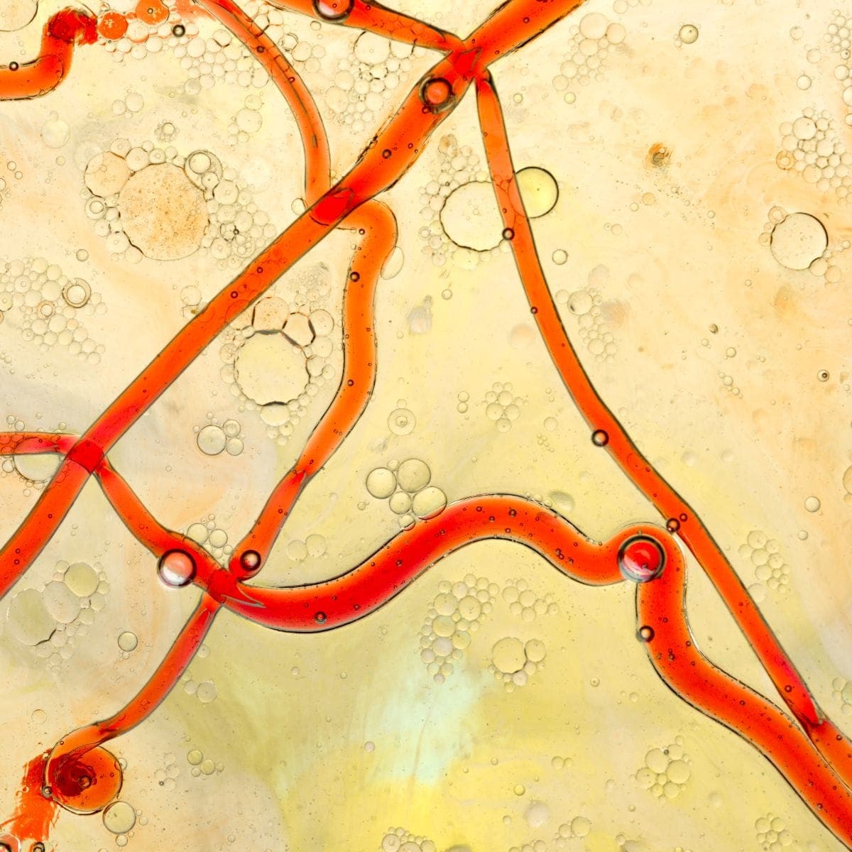 Nattokinase and Cholesterol
